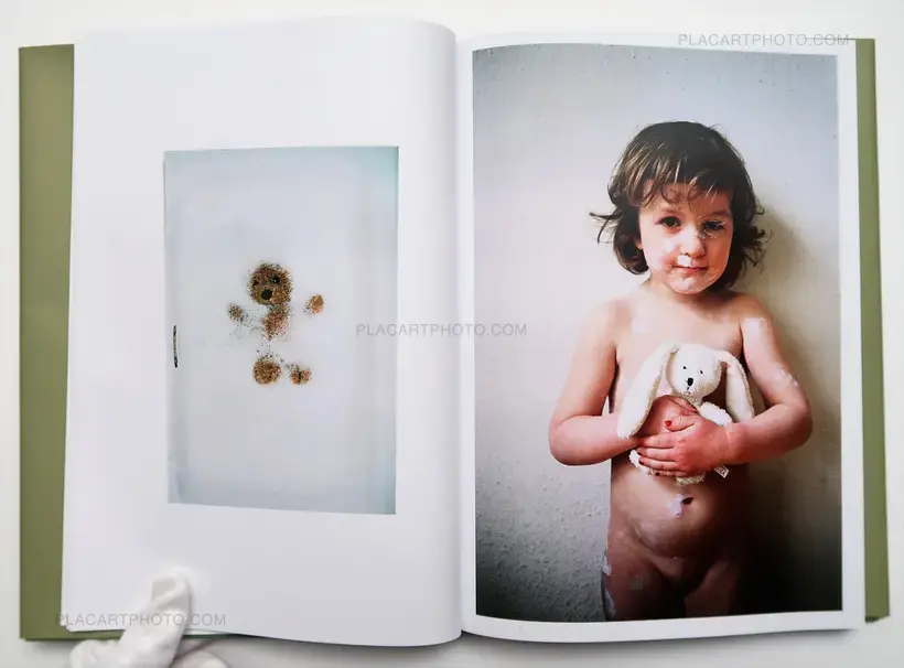 Sommerherz (LTD AND SIGNED)