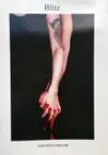 Blitz