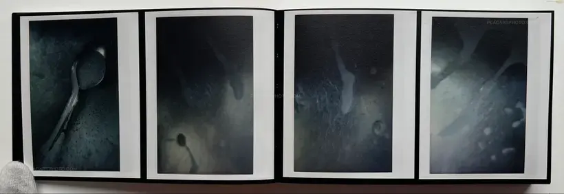 Abnormal heartbeat, and breathing (Signed)