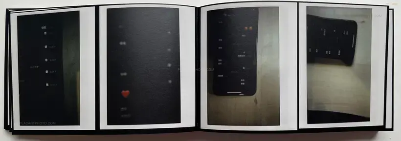 Abnormal heartbeat, and breathing (Signed)