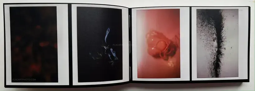 Abnormal heartbeat, and breathing (Signed)