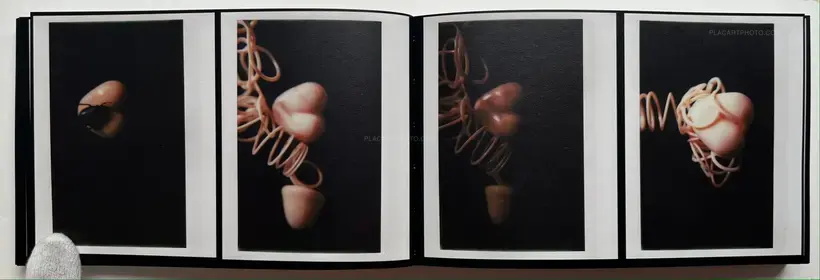 Abnormal heartbeat, and breathing (Signed)