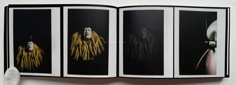 Abnormal heartbeat, and breathing (Signed)