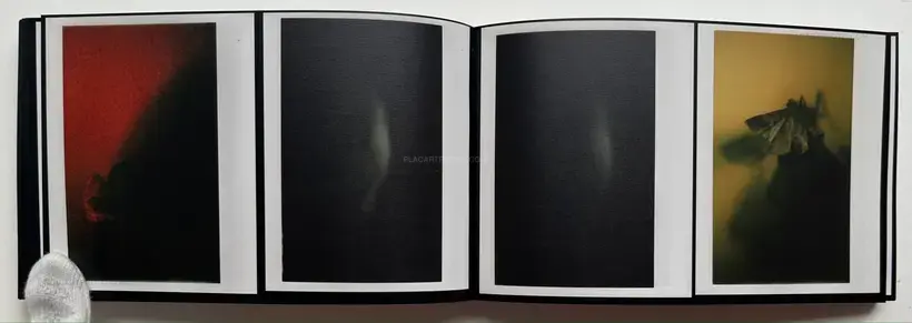 Abnormal heartbeat, and breathing (Signed)