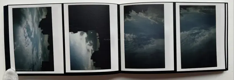 Abnormal heartbeat, and breathing (Signed)