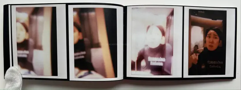 Abnormal heartbeat, and breathing (Signed)