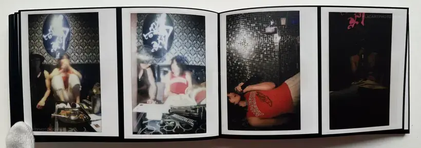 Abnormal heartbeat, and breathing (Signed)