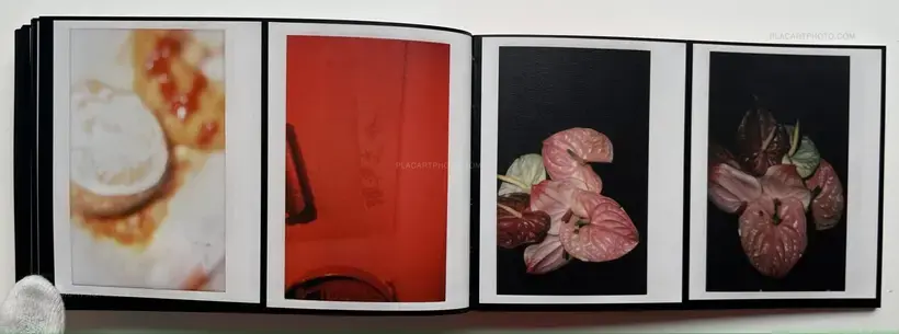 Abnormal heartbeat, and breathing (Signed)