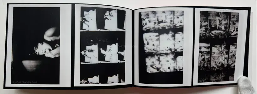 Abnormal heartbeat, and breathing (Signed)