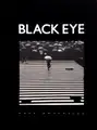 Black Eye