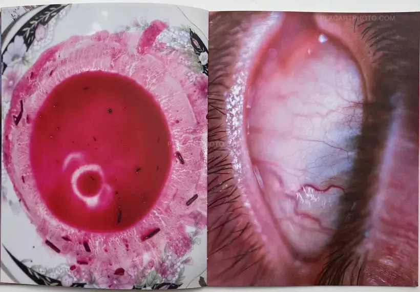 CUMQUAT (SIGNED ONLY 20 COPIES)