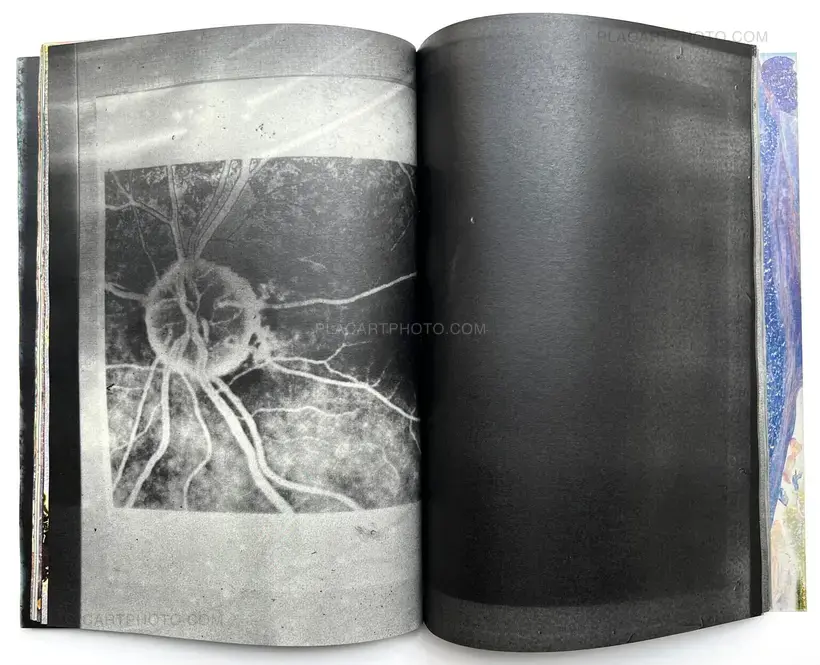 Matter (Cover A) (Signed, Unique edition)