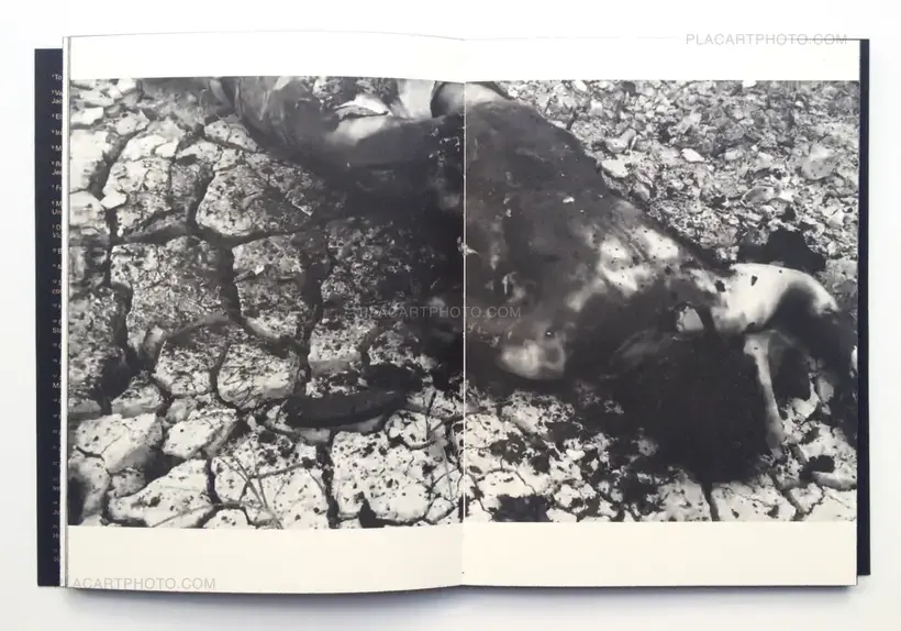 ANAESTHESIA (SIGNED)