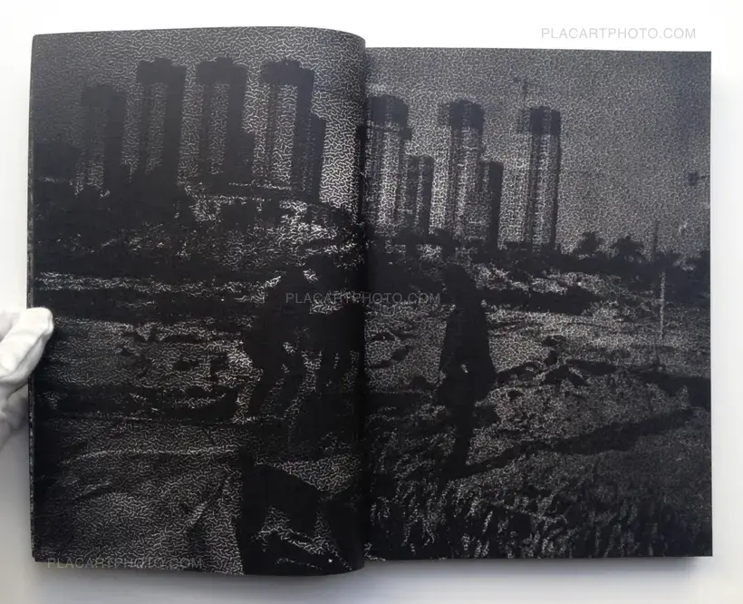 MATTER / BURN OUT (Signed)