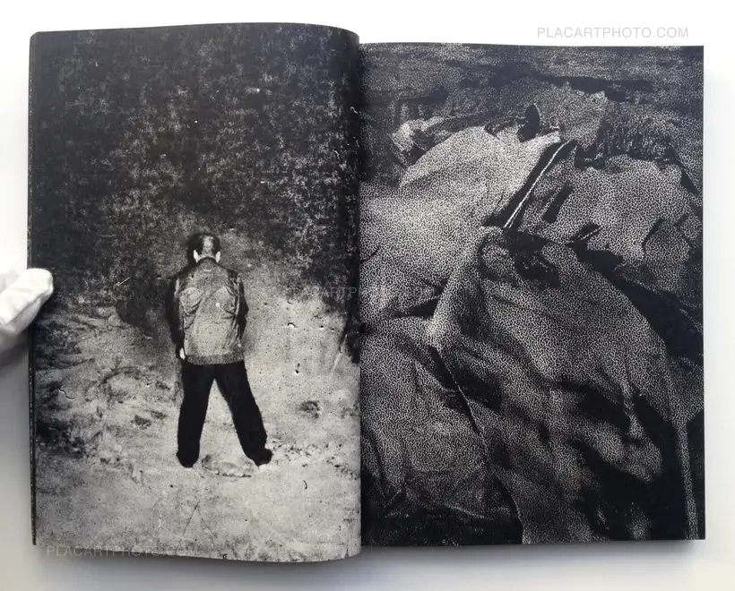 MATTER / BURN OUT (Signed)