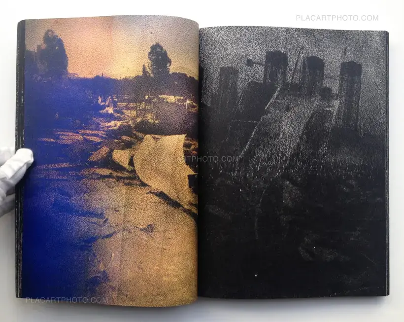 MATTER / BURN OUT (Signed)