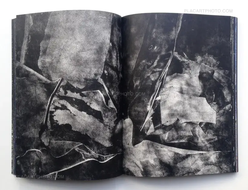 MATTER / BURN OUT (Signed)