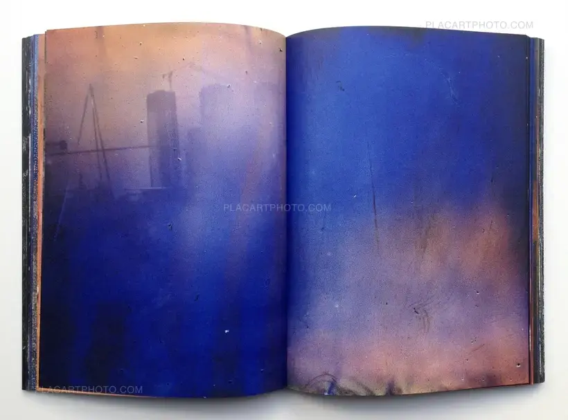 MATTER / BURN OUT (Signed)