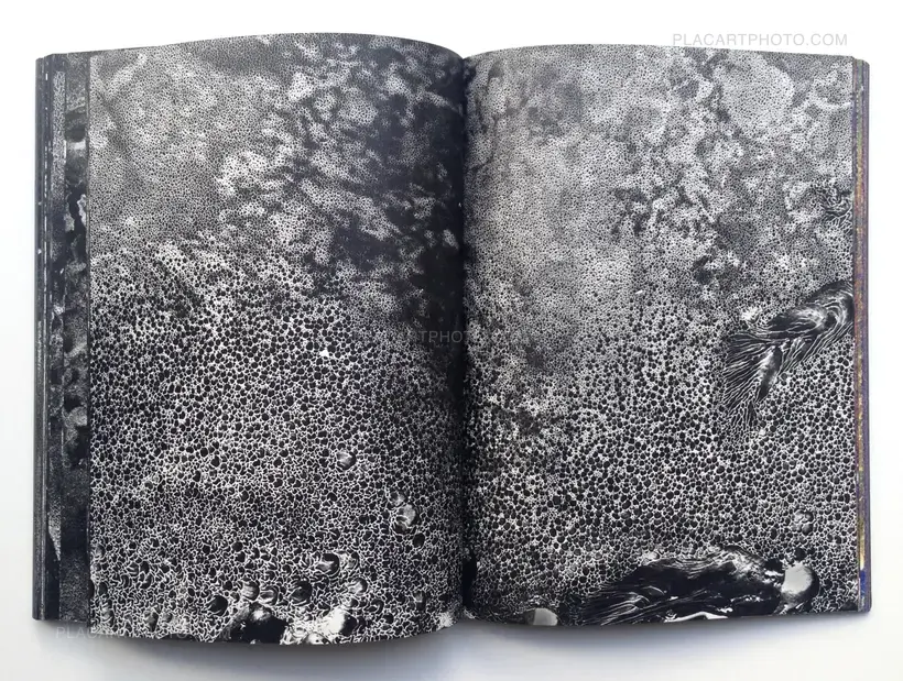 MATTER / BURN OUT (Signed)