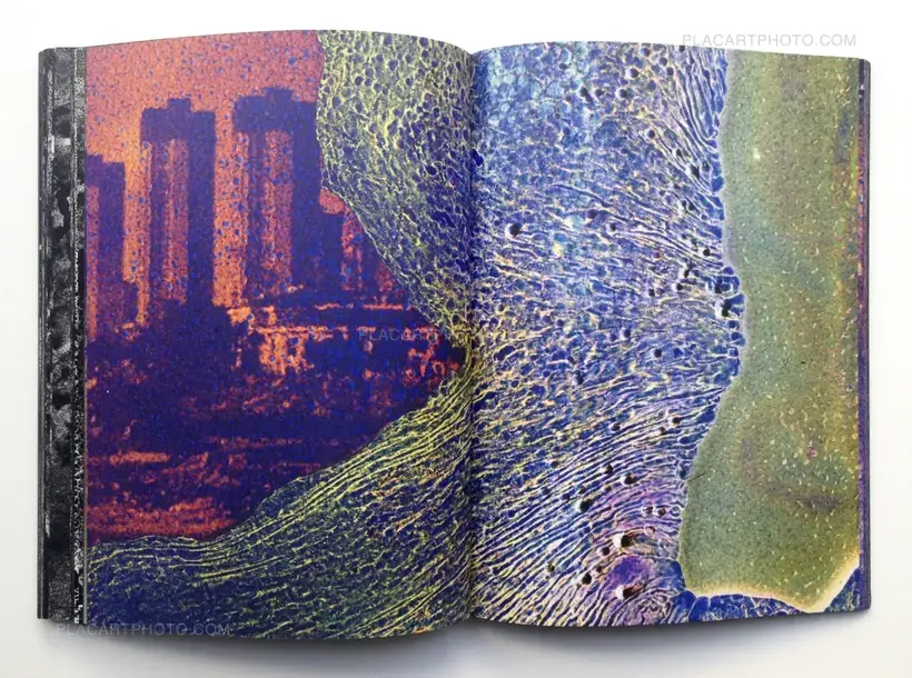 MATTER / BURN OUT (Signed)