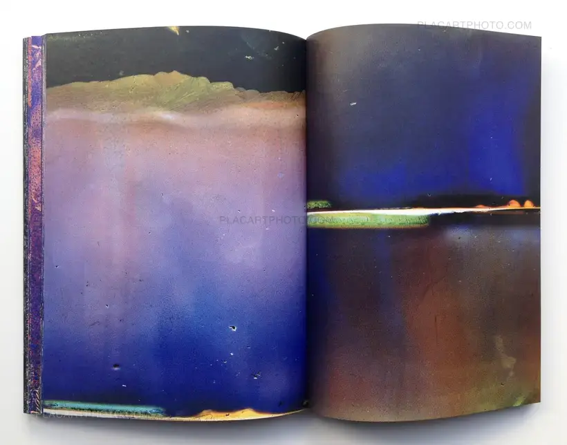 MATTER / BURN OUT (Signed)