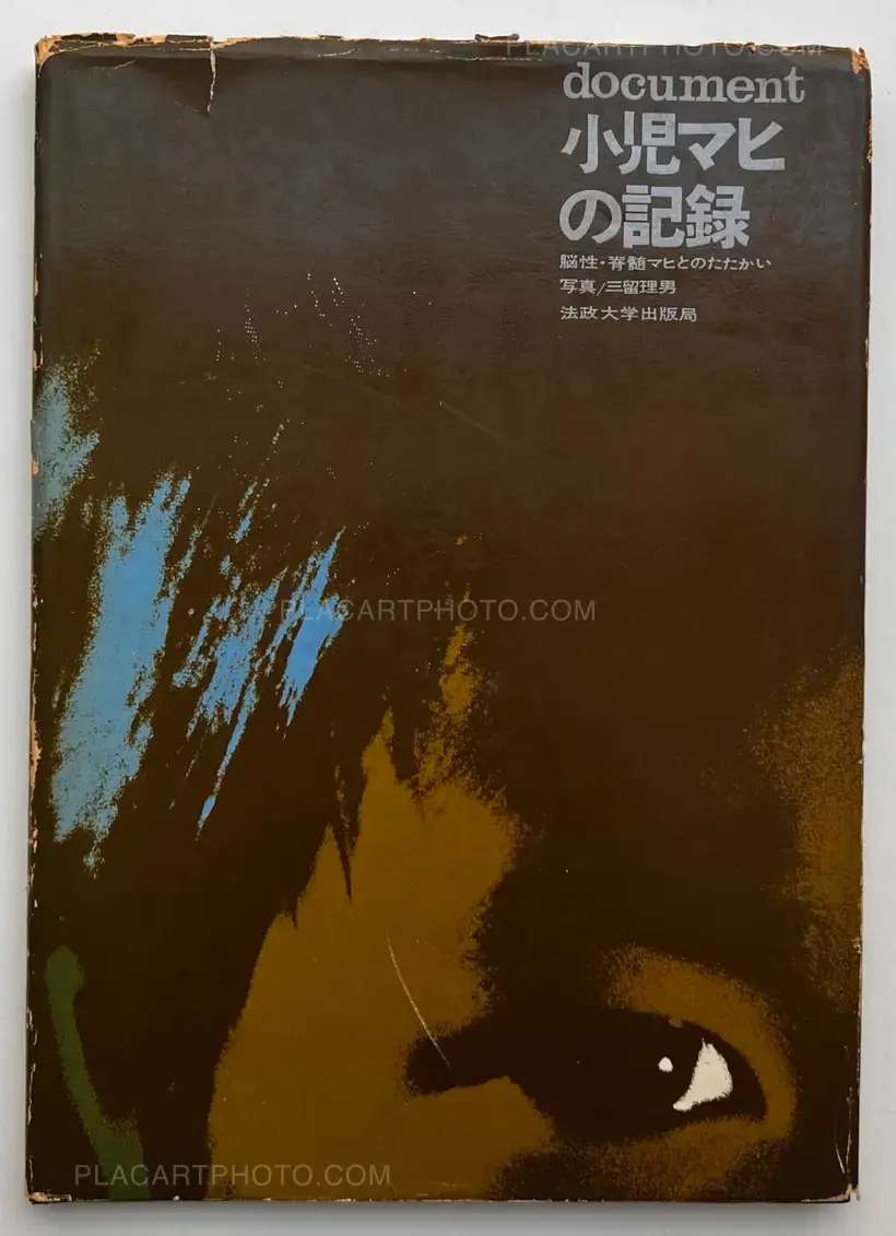 Document : Shonimahi no kiroku / Document : Record of Infantile paralysis