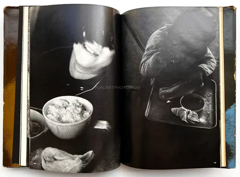 Document : Shonimahi no kiroku / Document : Record of Infantile paralysis