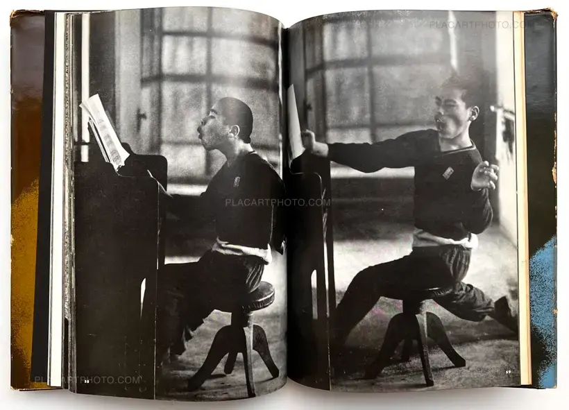 Document : Shonimahi no kiroku / Document : Record of Infantile paralysis