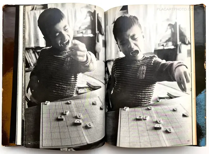 Document : Shonimahi no kiroku / Document : Record of Infantile paralysis